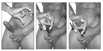 Special exercise to increase the penis