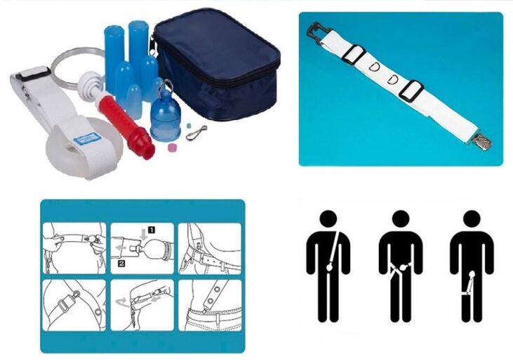 Penis lengthening and widening can be done on a stretcher